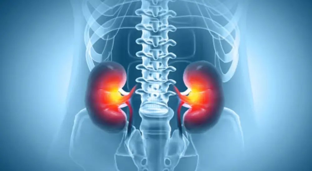 understanding-chronic-kidney-disease